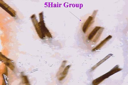 5 hair group