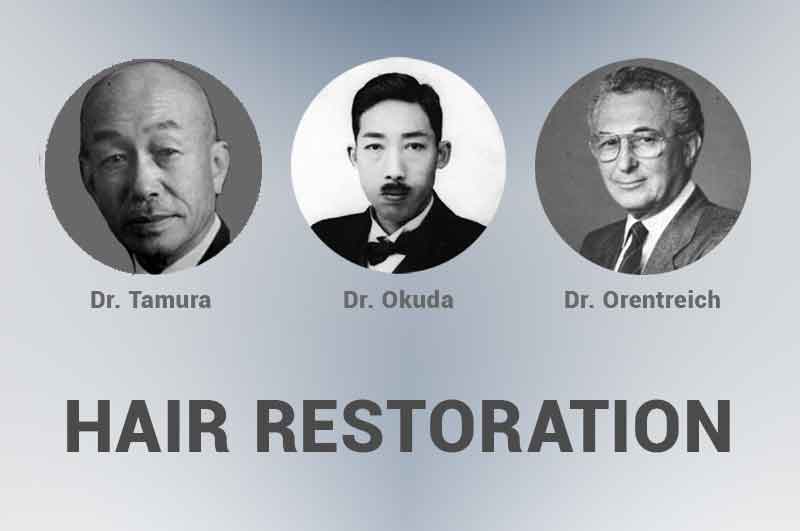 history hair transplant