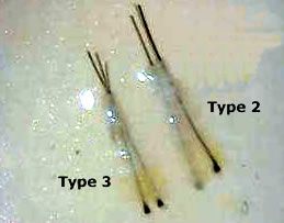 type 2 type 3 FU