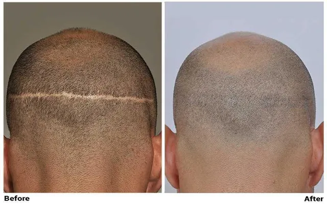 Non-surgical solutions