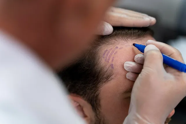 hair treatment procedure