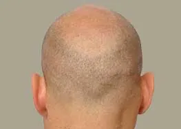 www.forhair.com/