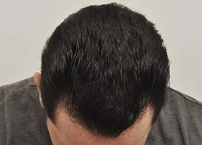 www.forhair.com/
