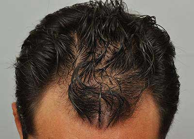 www.forhair.com/