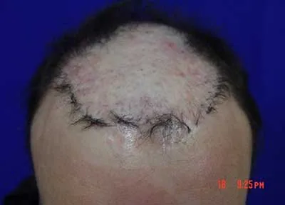 www.forhair.com/