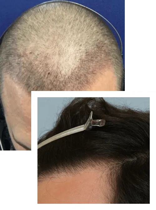 Hair Restoration Clinic