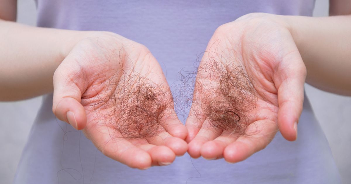 Possible excessive hair loss during Telogen phase