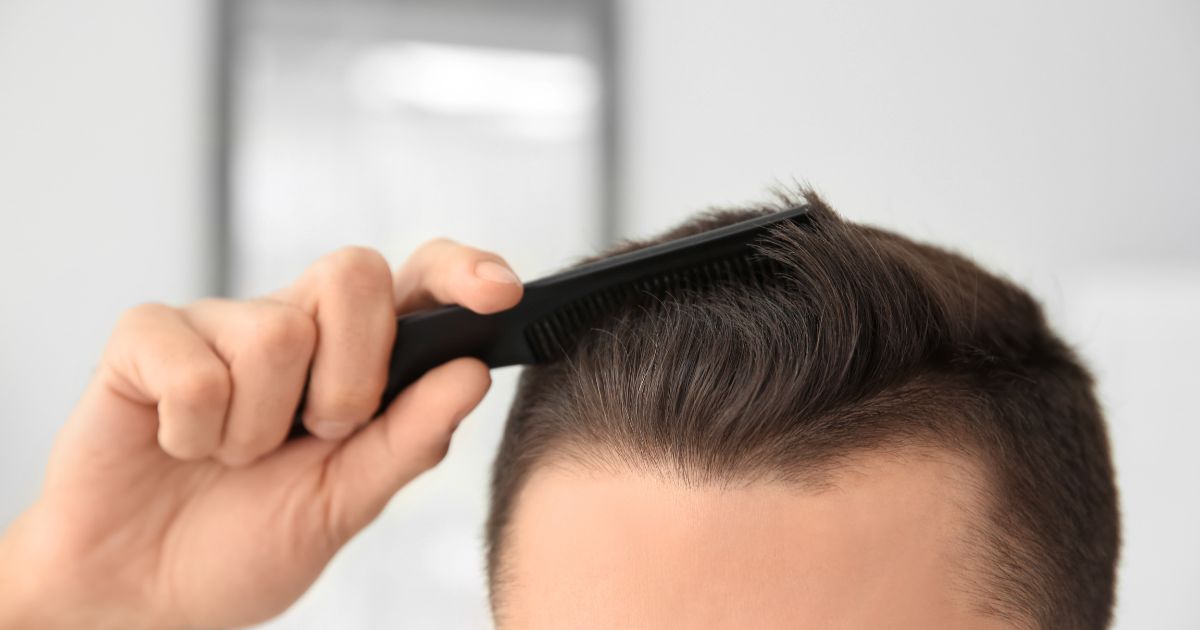 Take action on your receding hairline early.