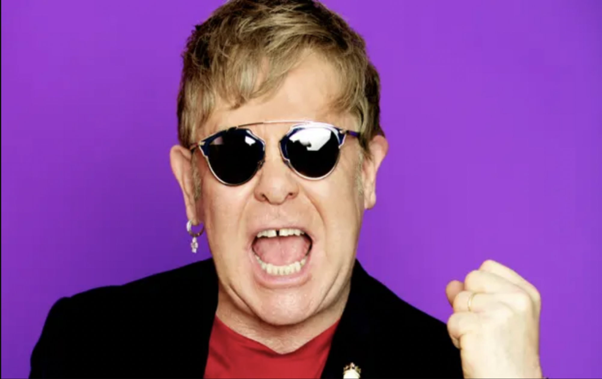 The Elton John Hair Transplant: Compared to yesteryears, it is visibly thicker (ctto John. Photograph: PR company handout from theguardian.com.)