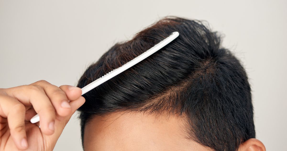 Hair loss is significantly influenced by disruptions in the Anagen or Telogen phase. 